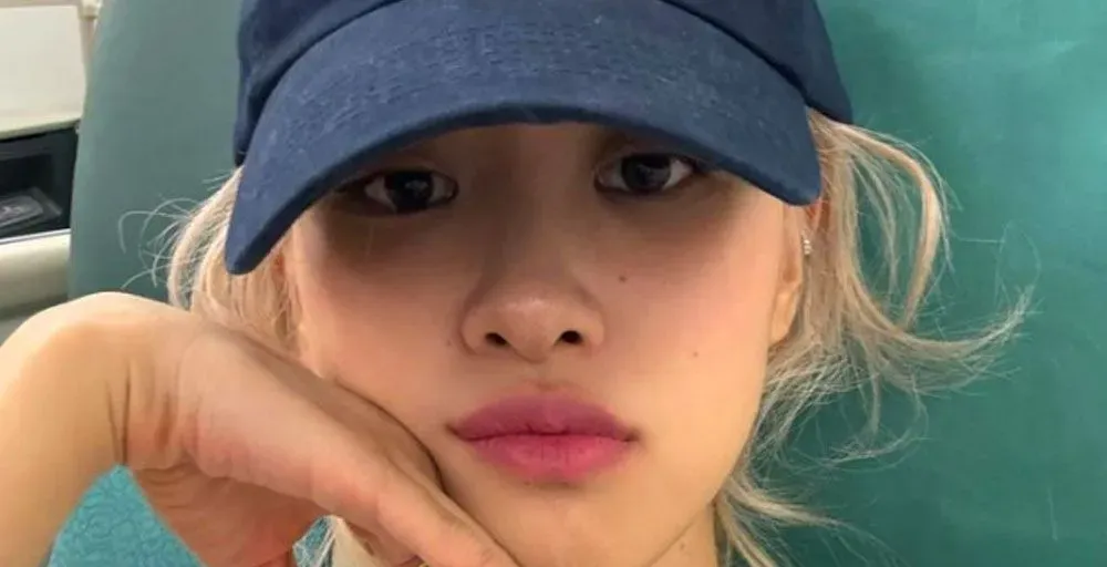 BLACKPINK Rosé спростувала чутки про операцію на повіках однією вражаючою фотографією